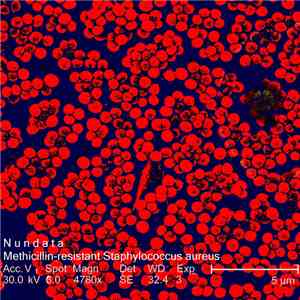 Nundata - Methicillin-Resistant Staphylococcus Aureus flac album