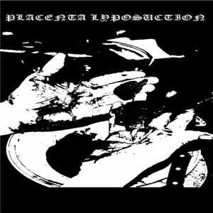Placenta Lyposuction / XSXCXEXBX - Placenta Lyposuction / XSXCXEXBX flac album