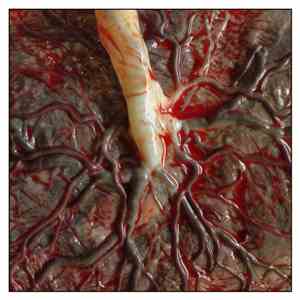 Unsignified Death - Yearning for the Womb flac album