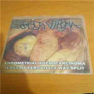 Serosa, Vipoma - Endometrial Adenocarcinoma (Loss Of Fertility) 2 Way Split flac album