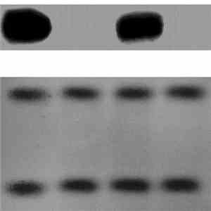 Fetal Programming - Fetal Programming flac album