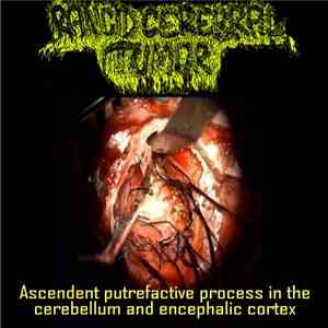Rancid Cerebral Tumor - Ascendent Putrefactive Process In The Cereberebellum And Encephalic Cortex flac album