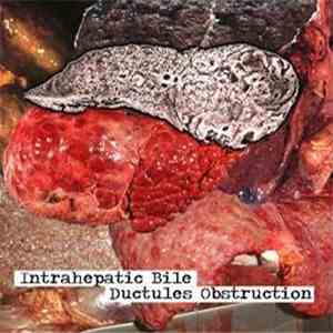 Biliary Cirrhosis - Intrahepatic Bile Ductules Obstruction flac album